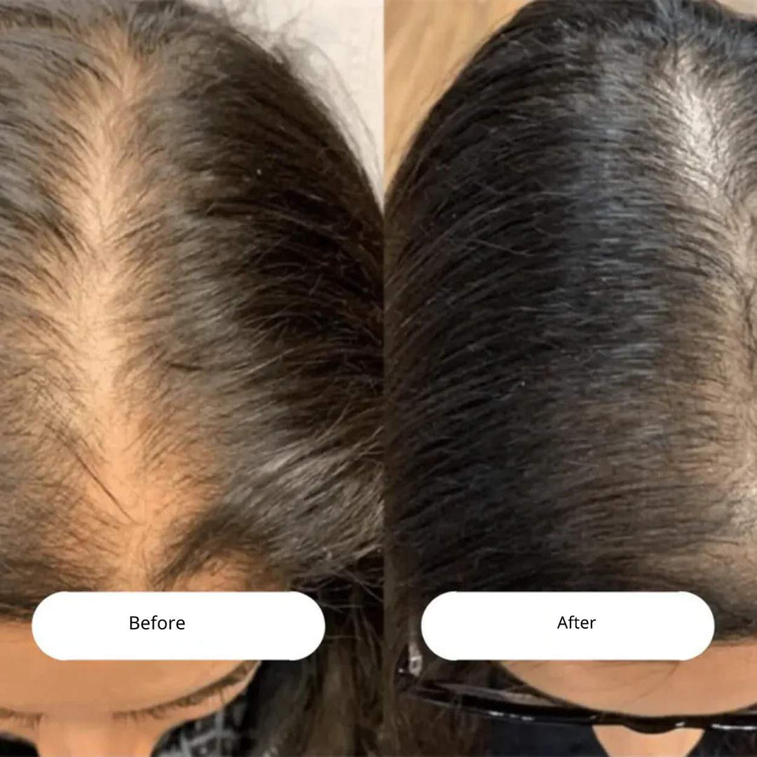 RadiantRoots™ | Discover Fuller Hair with the LED Hair Growth Comb