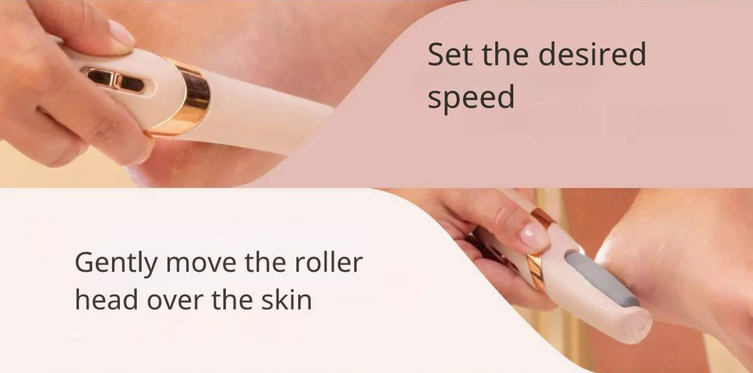Electric Pedicure Device™ | Instantly smooth skin!