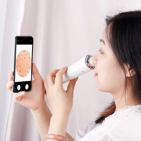 PureSight™ | Remove blackheads with precision