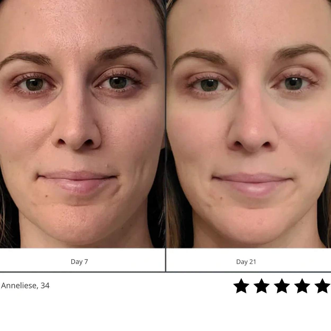 Light Beam Red™ | Feel Confident and Beautiful