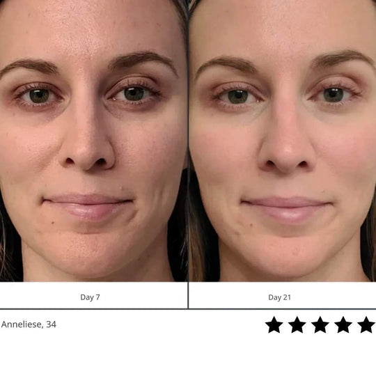 Light Beam Red™ | Feel Confident and Beautiful