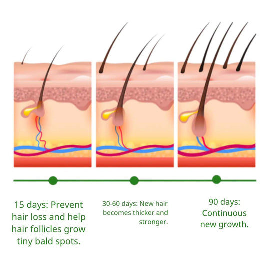 Rosemary Oil™ | Hair Growth