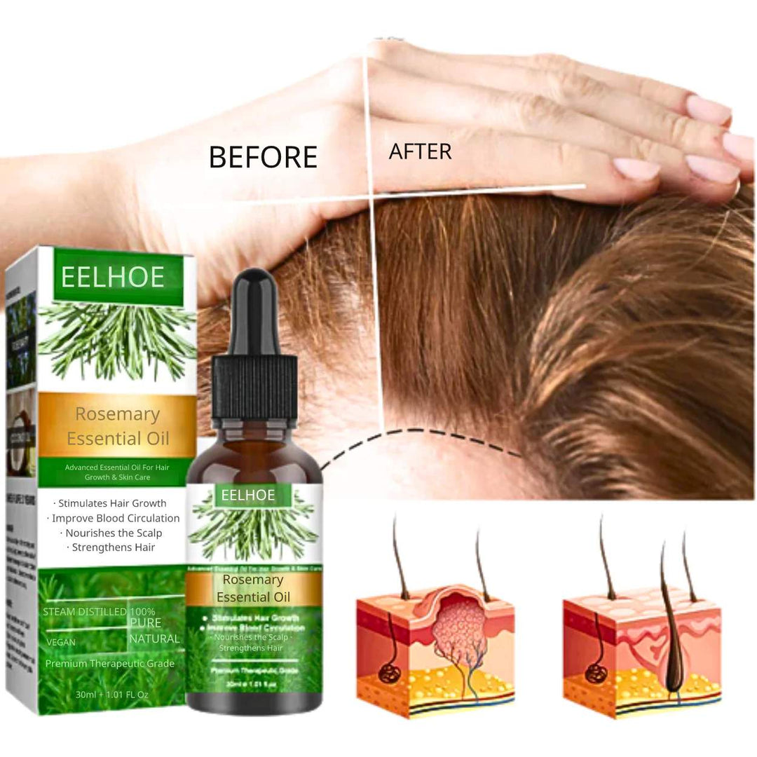 Rosemary Oil™ | Hair Growth