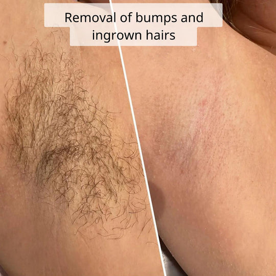BeautyGlide Pro™ | Create smoothness!