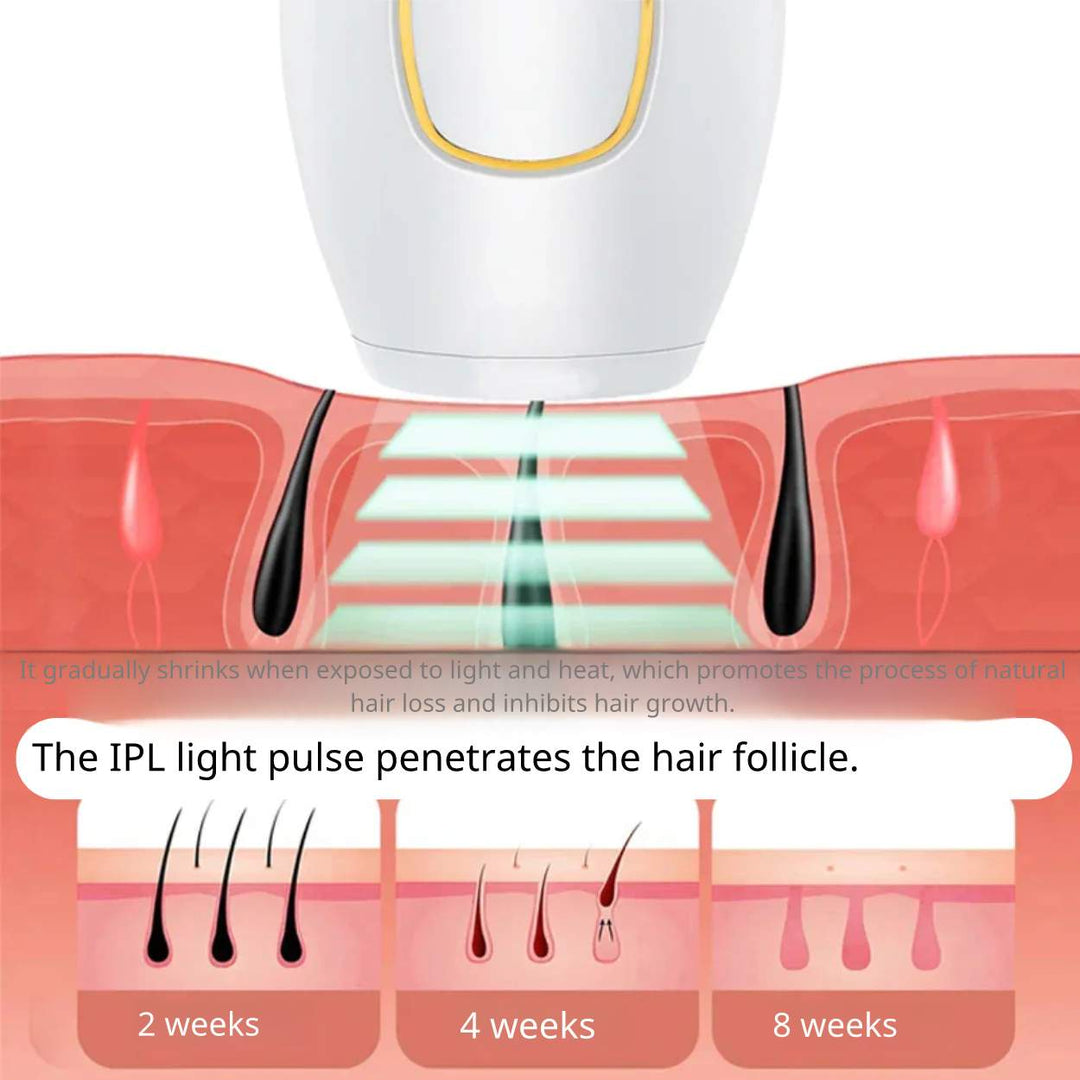 IPL Hair Removal™ | Say goodbye to unwanted hair