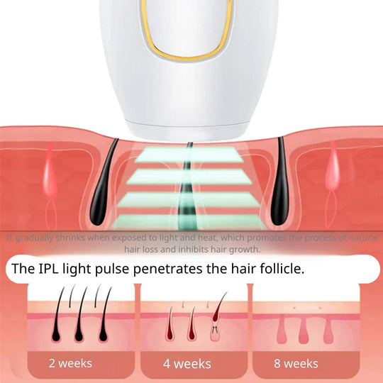 IPL Hair Removal™ | Say goodbye to unwanted hair