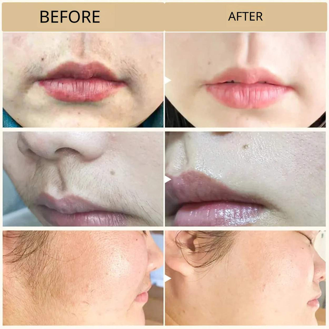 PureEase™ | Smooth and painless hair removal cream