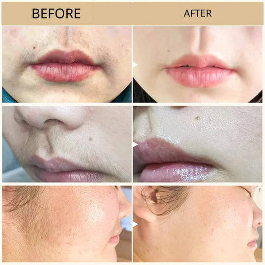 PureEase™ | Smooth and painless hair removal cream
