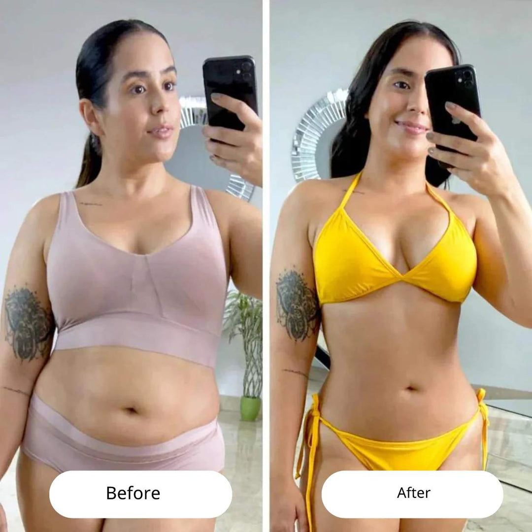VacuGlow™ | Ultimate cellulite solution for a flawless body