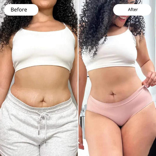 VacuGlow™ | Ultimate cellulite solution for a flawless body